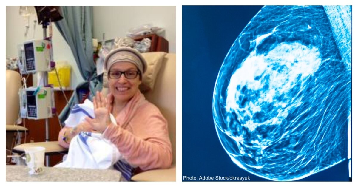 Breast cancer survivor shares brave photo of her double 