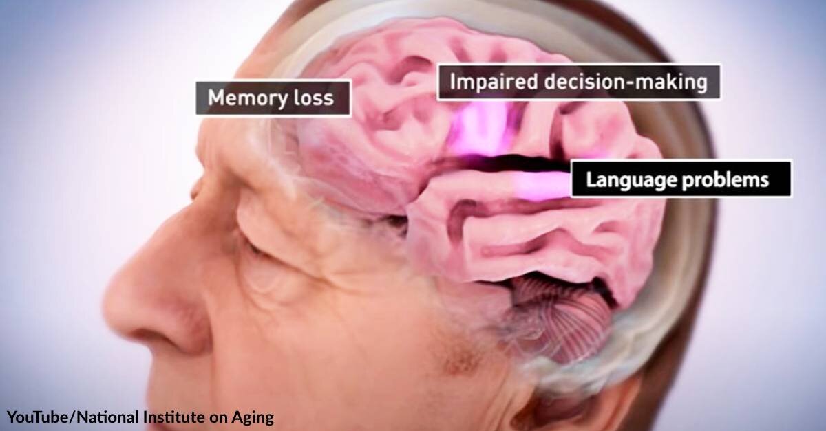 A New Study Shows Almost 50% of Older People Who Die Now are Diagnosed with Dementia