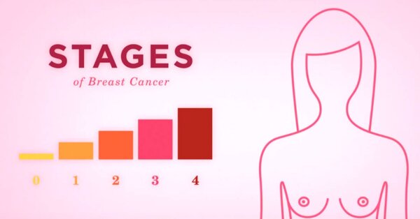 This List Breaks Down The Stages Of Breast Cancer And What They Mean 3447