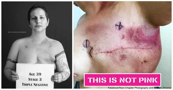 Survivor's Photos Show Reality of Cancer - The Breast Cancer Site News